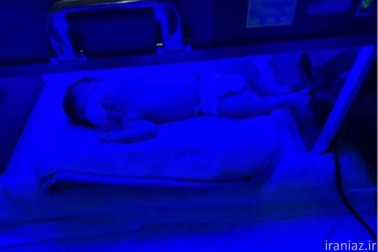 اجاره دستگاه فتوتراپی (زردی نوزاد)