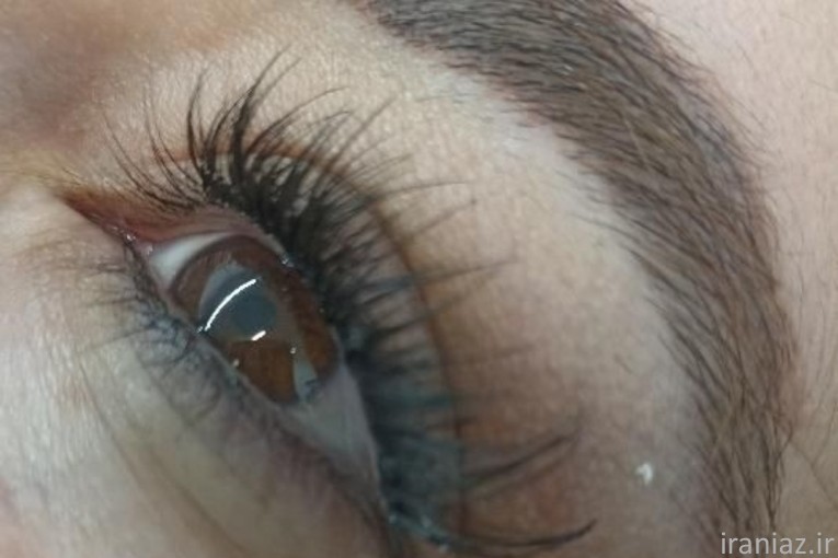 خدمات کاشت هیدن