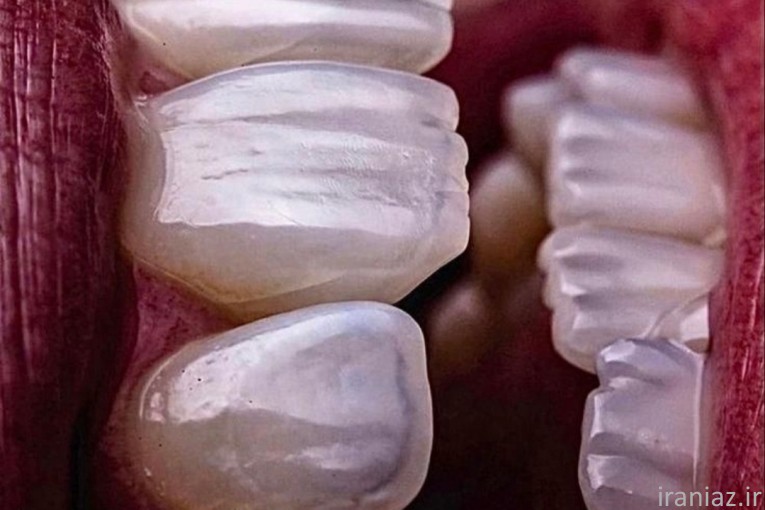 خدمات دندانپزشکی ایمپلنت