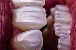خدمات دندانپزشکی ایمپلنت