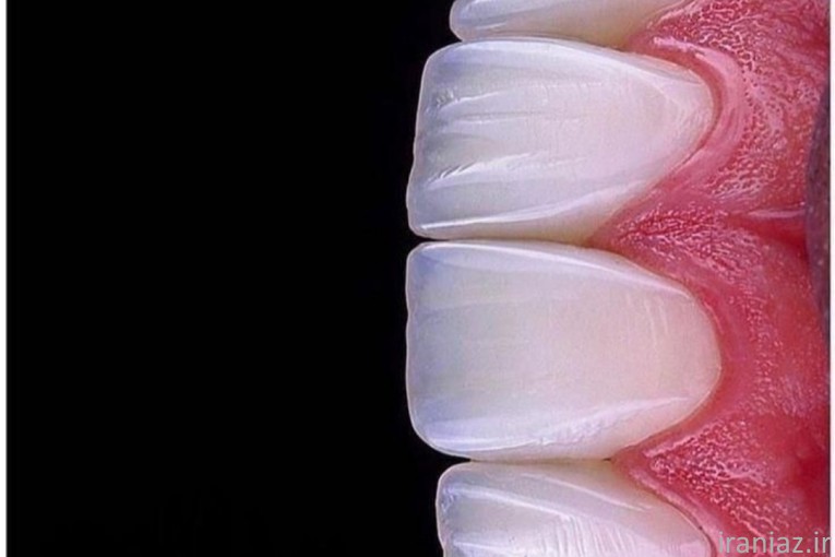 خدمات دندانپزشکی ایمپلنت و ...