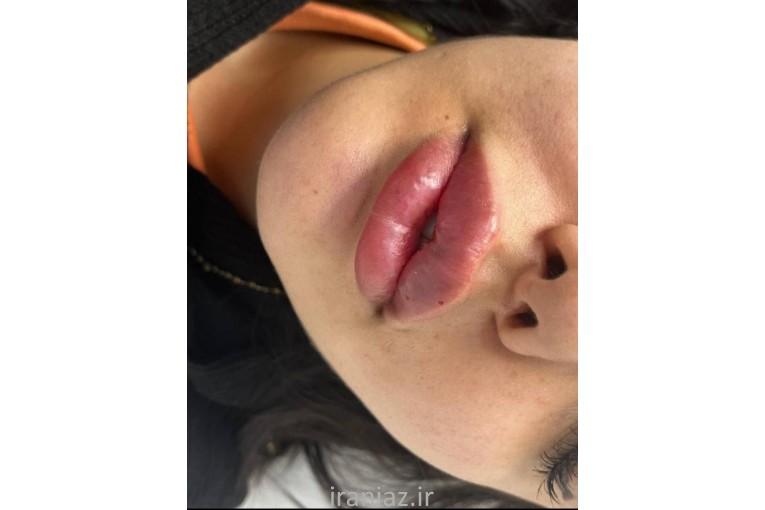 کانتورینگ صورت کلینیک گل آرا