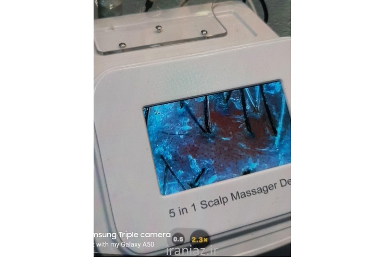 اسکراب اسکایپ پاکسازی کف سر