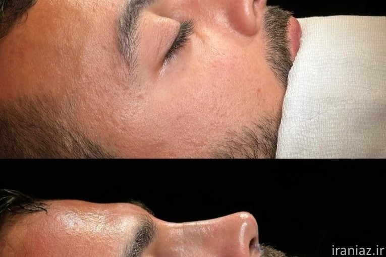 جشنواره عمل بینی و پلک