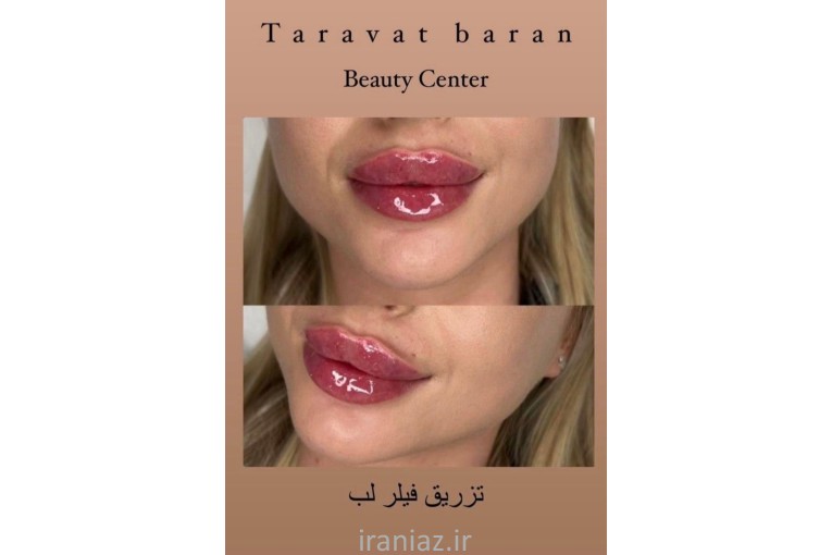 هایفو ۱۲ بعدی گلد بوتاکس و ...