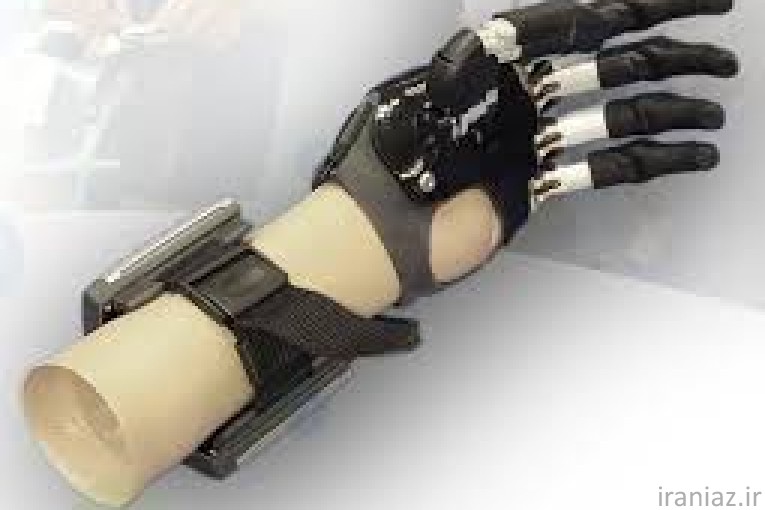 پای مصنوعی  پروتز