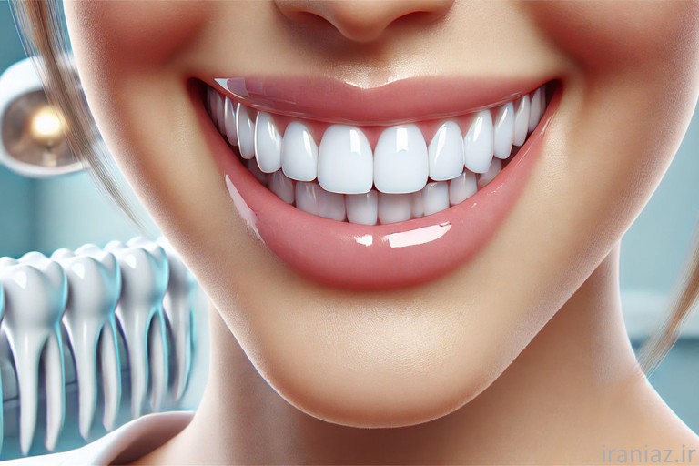 لمینت دندان: راهنمای جامع لمینت دندان، معایب و محاسنلمینت دندان